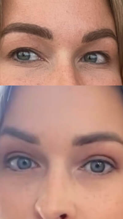 Janell Knight Before & After